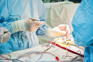 unnecessary surgery