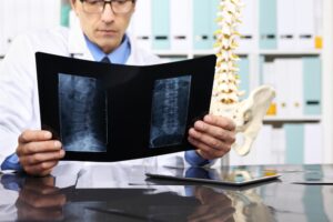 sepsis misdiagnosis