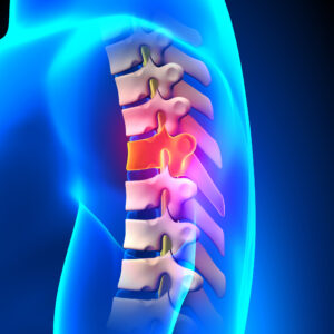 Spine anatomy representing Cauda Equina Medical Negligence