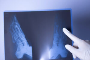 A doctor looks at a patients x-ray.