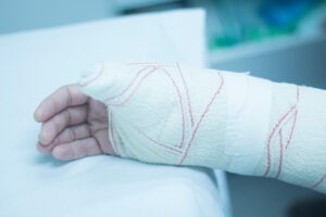 Hand and wrist in cast.
